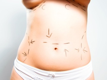 Lymphedema Post Plastic Surgery Diagnosis & Treatment