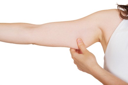 Are You A Candidate for Brachioplasty (Arm Lift) Plastic Surgery?