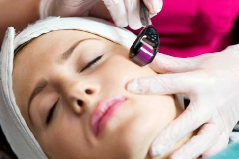 What Does Microneedling Do For Your Skin?