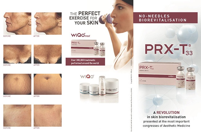 PRX-T33 WiQo Treatment (Chemical Peel With No Downtime)