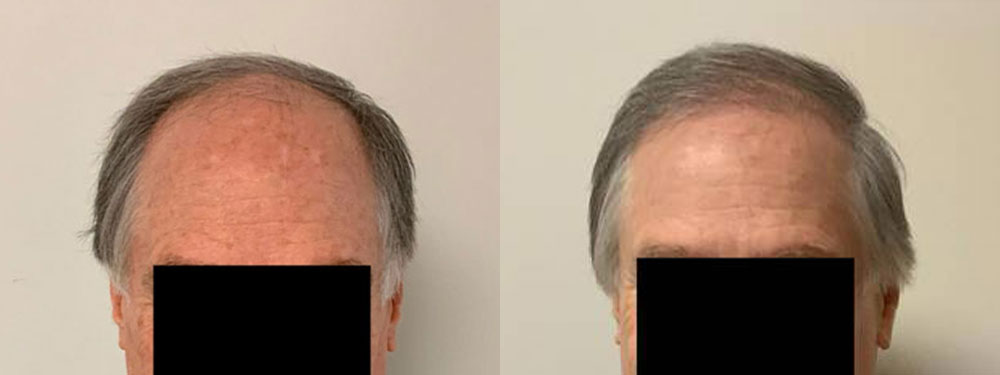 client